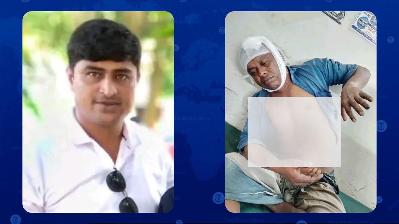 সুবর্ণচরে চাঁদাবাজির প্রতিবাদ করায় বিএনপি কর্মীকে কুপিয়ে জখম, অভিযুক্ত যুবদল নেতা