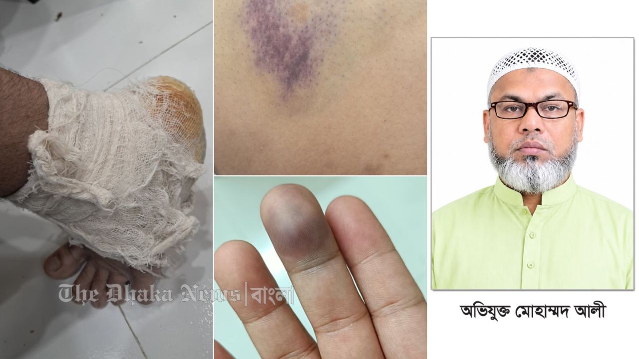 প্রতারণাকে আড়াল করতে চাঁদপুরে ব্যবসায়ীকে হত্যার চেষ্টায় অভিযুক্ত গ্রেপ্তার